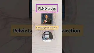 Pelvic lymphnode Dissection made easy. #youtubeshorts #trending #viral #video #study #neet #