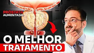 Raspagem da Próstata vs REZUM: Qual Deles EU RECOMENDO!