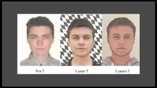 ТРАНСГЕНДЕР в Германии - Первое видео по-русски (2 года ЗГТ)