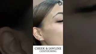 Cheek & Jawline Contouring 