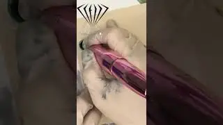 Видеообзор аппарата Pink Diamond