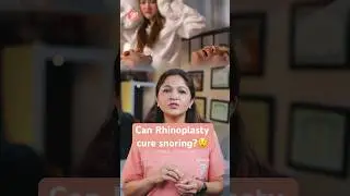 Rhinoplasty for Snoring | Can snoring be cured? #youtube #shorts #rhinoplasty #sbaesthetics