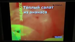 Фрагмент эфира (Тонус, 22.10.2022)