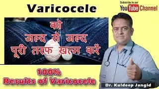 Varicocele का परमानेंट इलाज | 100% treatment of Varicocele | Best Treatment of Varicocele