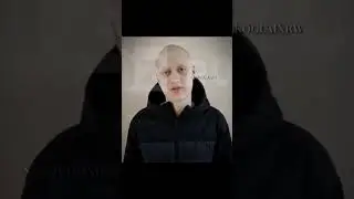 некоглая побрили надысо 