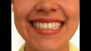 Занятия с логопедом - упражнение 