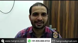 Best Hair Transplant | Delhi | Bahadurgarh | Rohtak |Hisar| Rampur |   Best Hair Transplant Results