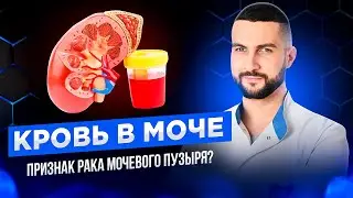 Диагностика рака мочевого пузыря