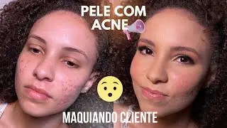 Aula BÔNUS! Maquiando Cliente: make Beauty em pele acneica, será que dá?