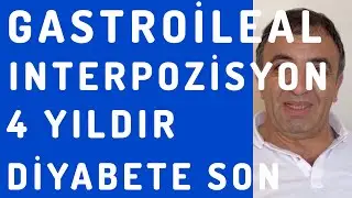 Diyabet Ameliyatı - Gastroileal İnterpozisyon - Şeker Ameliyatı