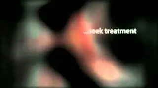 Eosinophilic Esophagitis in Adults