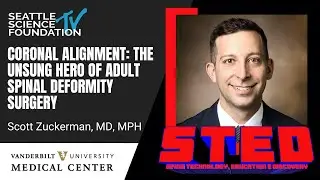 Coronal alignment: the unsung hero of adult spinal deformity surgery – Scott Zuckerman, MD