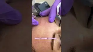Выталкиваем дно морщин наружу и пропитываем кожу: 