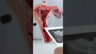 Khawatir Hamil Lagi Setelah Melahirkan ? Ini Gejala yang Harus Diwaspadai