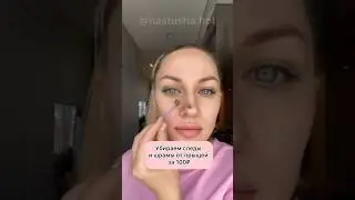 Убираем следы и шрамы от прыщей