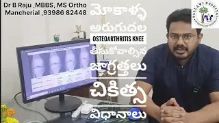 మోకాళ్ళ అరుగుదల(Osteoarthritis Knee)తీసుకోవాల్సిన జాగ్రత్తలు, చికిత్స విధానాలు| Dr Raju| Mancherial
