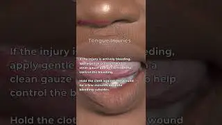 First Aid for Tongue Injuries - Control the Bleed