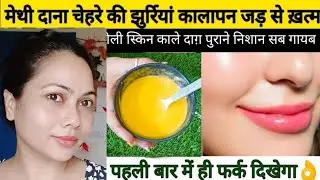Best Homemade Mask for Pigmentation Removing | Skin Whitening Face Pack | Best Remedy Pigmentation |