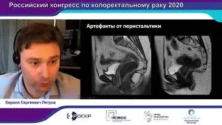 РККР 2020. МАСТЕР-КЛАСС ПО ЛУЧЕВОЙ ДИАГНОСТИКЕ И КОМБИНИРОВАННОМУ ЛЕЧЕНИЮ РАКА ПРЯМОЙ КИШКИ