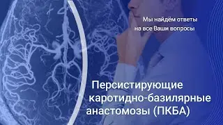 Персистирующие каротидно-базилярные анастомозы