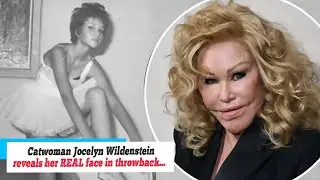 News: Catwoman Jocelyn Wildenstein reveals her REAL face in throwback snap taken before infamous...