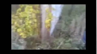 Оторвало кисть вызрывом