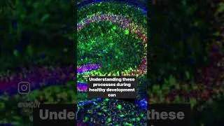 Mouse #brain under microscope #neuroscience #neuropsychology #research #science #shorts #NIH