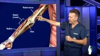 Radial Tunnel Surgery
