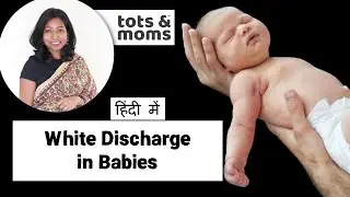 शिशुओं में सफेद स्राव | White Discharge in Newborn Girl Babies in Hindi - Causes & Care