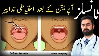 after tonsillectomy care/tonsils operation k bad kia ihtiyat krna chahie