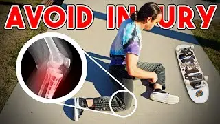Prevent Skateboarding Injury (5 Warm Up Exercises)