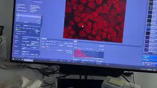 Performance comparison (ZEISS) - Part 13/14 #zeiss  #microscope #fluorescence