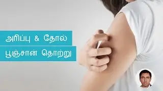 Skin Fungal Infections Symptoms, Causes, Treatments | Tamil