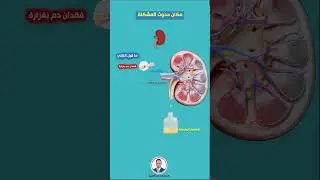 خطورة احتباس السوائل فى الجسم