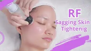 RF FACIAL| NON SURGICAL FACELIFT | HOW TO USE RADIO FREQUENCY | FACE SKIN TIGHTENING TREATMENT |1391