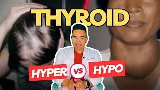 Top 10 Signs ng Thyroid Problem 