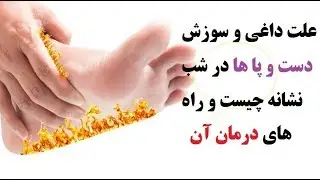 داغی و سوزش دست و پا ها در شب نشانه چیست و راه های درمان آن