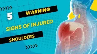 5 WARNING Signs Of Injured Shoulders