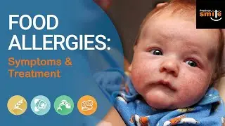 food allergy in kids | food allergies | food allergy symptoms