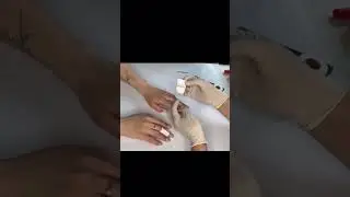 Лечим мигрень за 1 минуту!