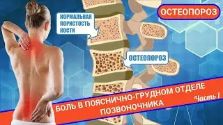 БОЛЬ В ПОЯСНИЧНО-ГРУДНОМ ОТДЕЛЕ || Остеопороз (Часть 1)