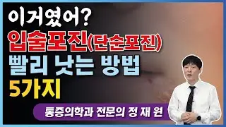 단순포진, 헤르페스 입술포진 빨리 낫는 방법 5가지! 꿀팁! (입술포진, 단순포진)/ 흉선자극술