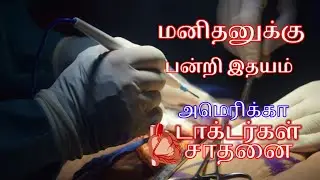 மனிதனுக்கு பன்றி இதயம் சாதனை படைத்த அமெரிக்க டாக்டர்கள் / facts tamil