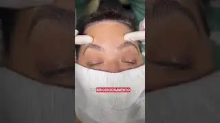 FEMINIZAÇÃO FACIAL | Transgender Center Brazil