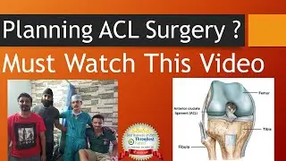 ALL you want to know before Getting ACL Surgery.  ACL walkthrough in English
