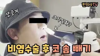 비염수술 생생 후기ㅣ 비염수술 후 코 솜빼기 ( 비중격만곡증 축농증 기능코성형 등 )