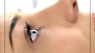 Визин