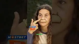Питбуль оторвал ЕЙ верхнюю губу, операция стоимостью 400 000 $ 