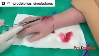 Sutura en mano