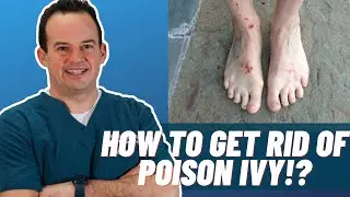How to get rid of poison ivy | Dr. Nick Campitelli | 